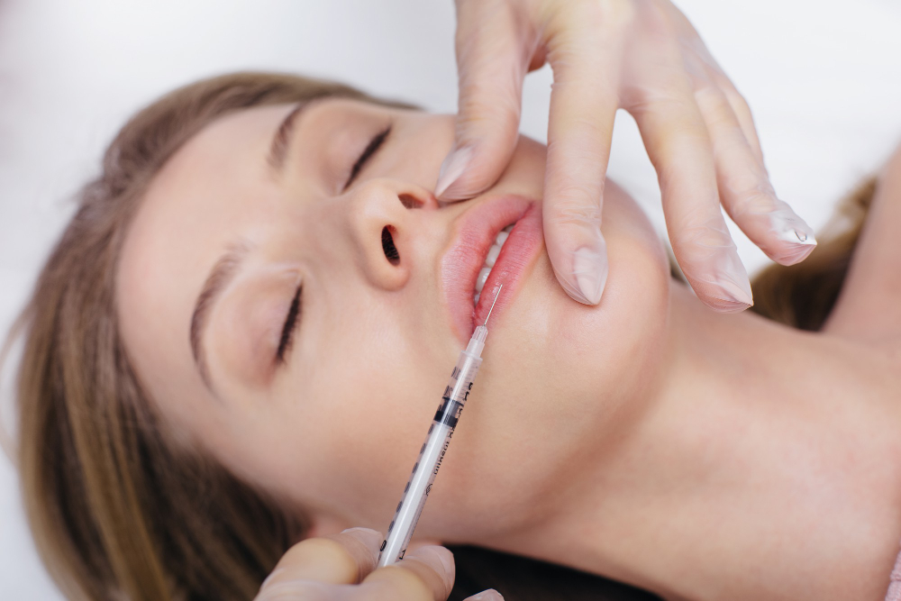 Dermal Fillers