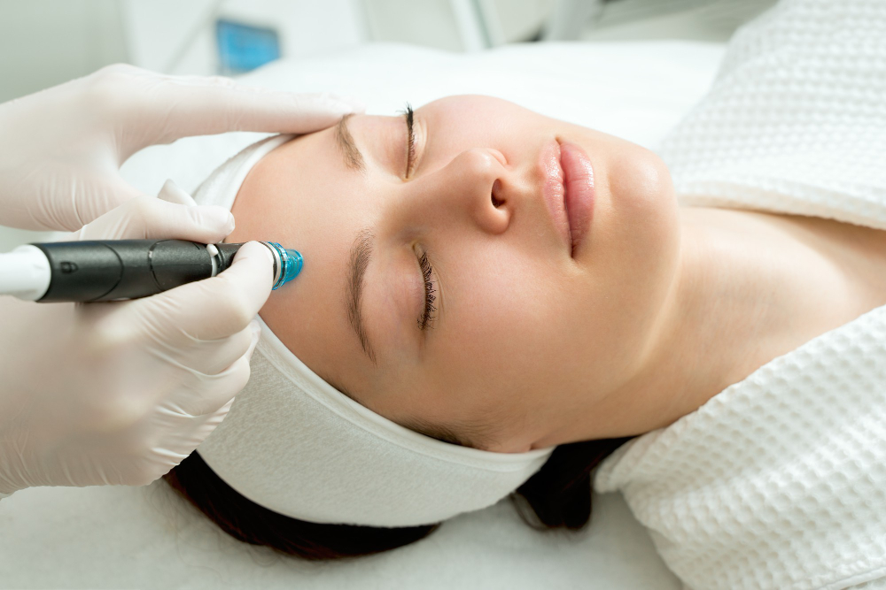 Microneedling with PRP